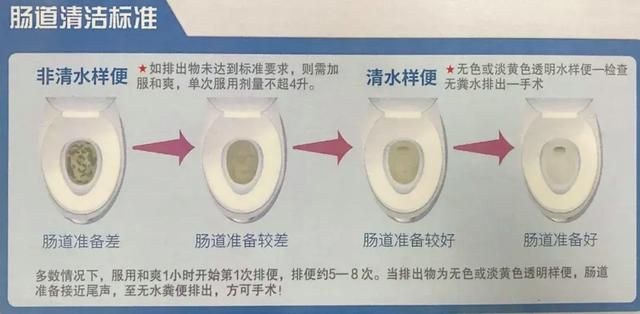 高质量肠镜检查，守护肠道健康的隐形盾牌